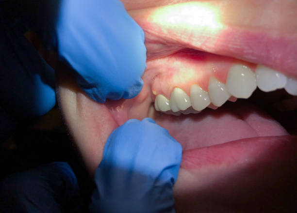 Best Emergency Dental Care for Trauma or Injury in Iowa Park, TX
