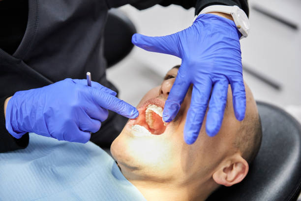 Best Emergency Wisdom Teeth Removal in Iowa Park, TX
