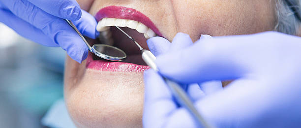 Best Emergency Root Canal Treatment in Iowa Park, TX